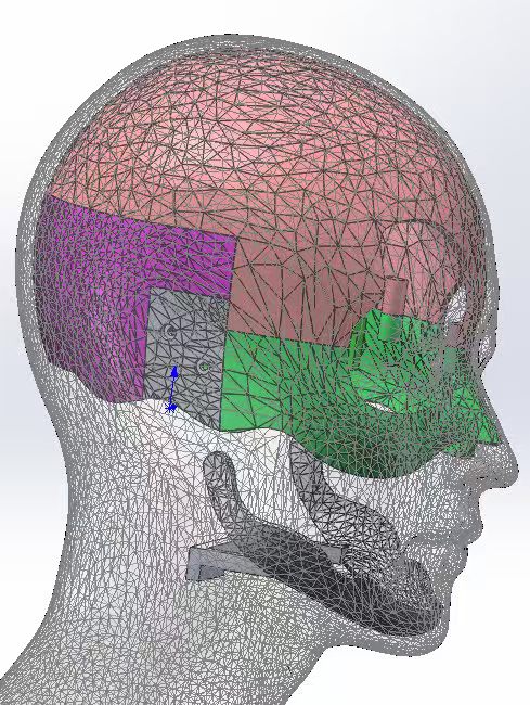 Side-profile CAD with the skull divided into colour-coded mechanical modules